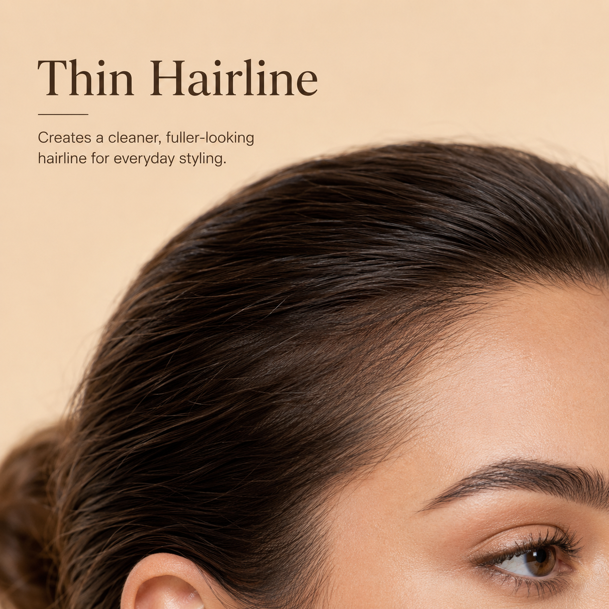 Thin Hairline